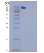 小鼠CHL-1重组蛋白Fc tag