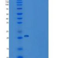 人线粒体蛋白酪氨酸磷酸酶1(PTPMT1)重组蛋白His tag