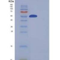 人SMYD3 / ZMYND1重组蛋白His & FLAG tag