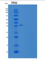 人Resistin / ADSF / RETN重组蛋白Fc 