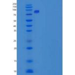 人PKC iota / PRKCI重组蛋白GST tag