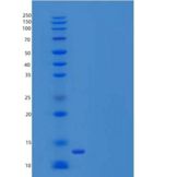 人组蛋白2簇H2be(HIST2H2BE)重组蛋白