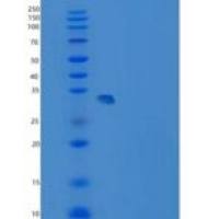 人CMBL重组蛋白His tag