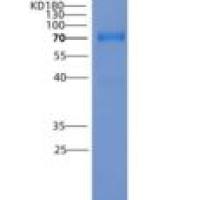 人PS6K / RPS6KB1重组蛋白GST tag