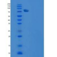 大鼠视黄醇结合蛋白4(RBP4)重组蛋白His tag