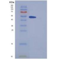 小鼠METAP2 / MAP2重组蛋白His tag