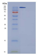 人A2M/cpam D5/α-2-巨球蛋白重组蛋白His t