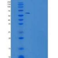 小鼠USP46重组蛋白SUMO tag