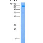 人IGSF3 / EWI-3重组蛋白His tag