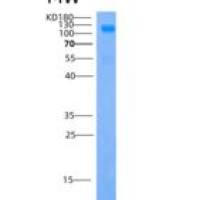 人IGSF3 / EWI-3重组蛋白His tag