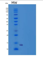 小鼠CD90 / THY-1重组蛋白His tag