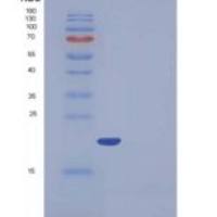 人铁蛋白轻链重组蛋白His Tag