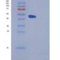 人羧肽酶E(CPE)重组蛋白His tag