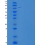 人ALDH4A1重组蛋白His & GST tag