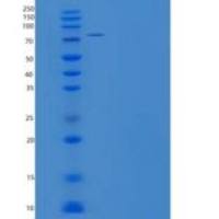 人ALDH4A1重组蛋白His & GST tag