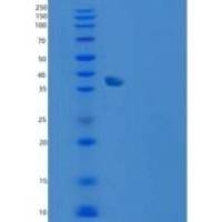 人Carbonic Anhydrase X / CA10重组蛋白His tag