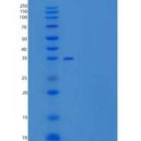 小鼠CD59a / Protectin / MAC-IP重组蛋白Fc tag