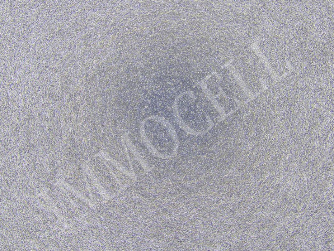 逸漠生物iPSC诱导肺类器官产品