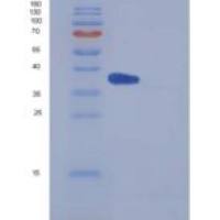 小鼠IL5Ra / CD125重组蛋白His tag