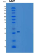 人线粒体蛋白酪氨酸磷酸酶1(PTPMT1)重组蛋白His t