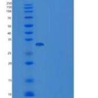人Carbonic Anhydrase II / CA2重组蛋白His tag