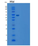 小鼠SPN / CD43重组蛋白Fc tag