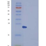 人过氧化还原酶2(PRDX2)重组蛋白His tag