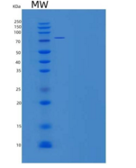 人ALDH4A1重组蛋白His & GST tag