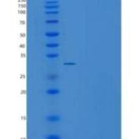 小鼠ART4 / CD297重组蛋白His tag
