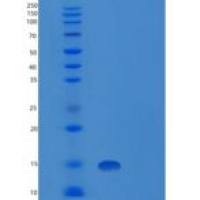 人神经突蛋白1(NRN1)重组蛋白His Tag
