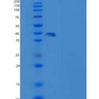 小鼠SIRPB1A / SIRP beta 1重组蛋白His tag