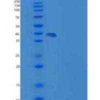 小鼠SIRPB1A / SIRP beta 1重组蛋白His tag