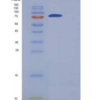 人GLT25D2重组蛋白His tag