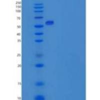 小鼠CDC2 Kinase / CDK1重组蛋白His & GST tag
