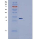 小鼠SPARCL1 / SPARC-like 1重组蛋白His tag