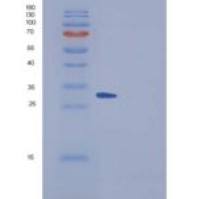 小鼠SPARCL1 / SPARC-like 1重组蛋白His tag