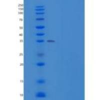 人ACP5 / TRAP重组蛋白His tag