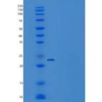 人CRADD / RAIDD重组蛋白His tag