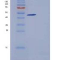 人ACPL2 重组蛋白His tag