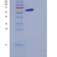 人干扰素诱导鸟苷酸结合蛋白1(GBP1)重组蛋白His tag