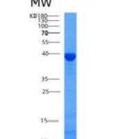 小鼠GFOD2重组蛋白His Tag