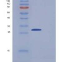 人Carbonic Anhydrase III / CA3重组蛋白His tag