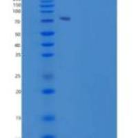 人乳铁传递蛋白(LTF)重组蛋白His tag