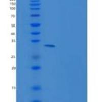 人sFRP1 / SARP2重组蛋白His tag