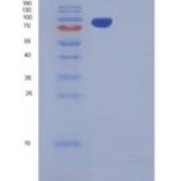 小鼠含CUB域蛋白1(CDCP1)重组蛋白Fc tag