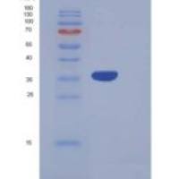 人脯氨酸丰富G羧基谷氨酸2(PRRG2)重组蛋白Fc Tag