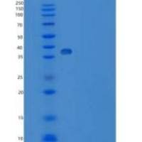 人甘丙肽(GAL)重组蛋白Fc tag