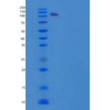 人信号素5A(SEMA5A)重组蛋白Fc tag