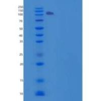 人信号素5A(SEMA5A)重组蛋白Fc tag