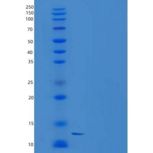 小鼠TALLA-1 / TSPAN7重组蛋白His tag